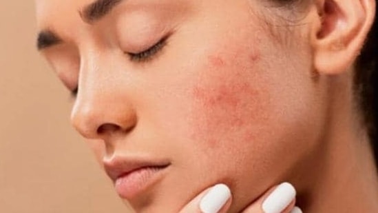 Are you having skin problems?