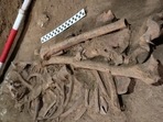 World's Earliest Successful Surgery: The skeleton was found in the caves of East Kalimantan. World's Earliest Successful Surgery: The skeleton was found in the caves of East Kalimantan.