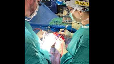 Lucknow doctors perform rare surgery, save woman with brain aneurysm (Pic is for representation only)