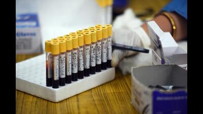 In the age group of 18 to 45 years, Pune district reported more vaccination in the last 10 days as compared to other groups, according to data from Co-WIN dashboard (HT FILE PHOTO) In the age group of 18 to 45 years, Pune district reported more vaccination in the last 10 days as compared to other groups, according to data from Co-WIN dashboard (HT FILE PHOTO)