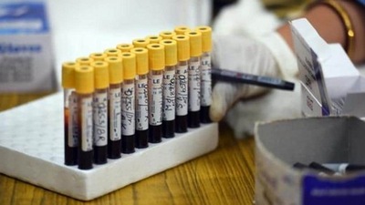 The number of people who have recuperated from the disease surged to 4,39,19,264, while the case fatality rate was recorded at 1.19 per cent. The number of people who have recuperated from the disease surged to 4,39,19,264, while the case fatality rate was recorded at 1.19 per cent.