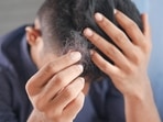 Hair thinning: Causes and treatment tips (Photo by Towfiqu barbhuiya on Unsplash) Hair thinning: Causes and treatment tips (Photo by Towfiqu barbhuiya on Unsplash)