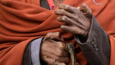 Pune ZP health department launches leprosy and tuberculosis eradication drive from September 13 to September 30. ((PIC FOR REPRESENTATION))