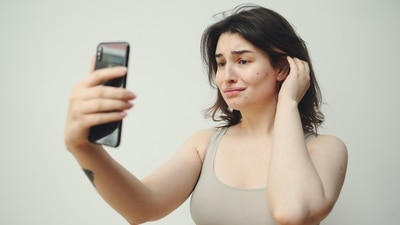 How to treat and prevent acne marks and scars? Expert share insights (pexels) How to treat and prevent acne marks and scars? Expert share insights (pexels)