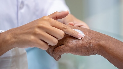 Skin health: Tips to control Atopic Dermatitis flare ups (Twitter/myCME) Skin health: Tips to control Atopic Dermatitis flare ups (Twitter/myCME)