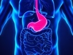 Gastrointestinal tract disorders and their causes that you should watch out for&nbsp;