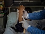 A doctor checks on a patient with sores caused by a monkeypox infection.(AFP) A doctor checks on a patient with sores caused by a monkeypox infection.(AFP)