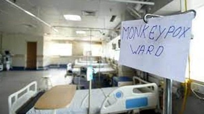 Monkeypox is a viral zoonosis (a virus transmitted to humans from animals), with symptoms similar to those in smallpox patients, though the disease is clinically less severe than smallpox. (HT Photo) Monkeypox is a viral zoonosis (a virus transmitted to humans from animals), with symptoms similar to those in smallpox patients, though the disease is clinically less severe than smallpox. (HT Photo)