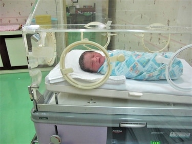 Blue baby syndrome is a congenital heart disorder in which oxygen deprived blood circulates in the baby's entire body. (Bayu Prakosa) Blue baby syndrome is a congenital heart disorder in which oxygen deprived blood circulates in the baby's entire body. (Bayu Prakosa)