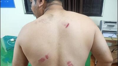 Pune police chief orders inquiry after family members, relatives and scrap association members staged a protest at Bundgarden police station demanding an FIR against an IRS officer for physically assaulting a scrap trader over GST penalty issues. (HT)