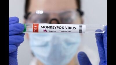 From July to August 2022, swab samples of 96 suspected monkeypox cases from 18 states and 3 Union Territories (UT) were sent to the ICMR-NIV for diagnosis of monkeypox. (REUTERS) From July to August 2022, swab samples of 96 suspected monkeypox cases from 18 states and 3 Union Territories (UT) were sent to the ICMR-NIV for diagnosis of monkeypox. (REUTERS)