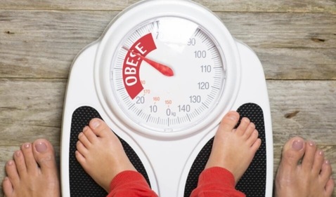 Obesity Obesity
