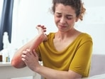 Atopic Dermatitis: Preventive measures and treatment