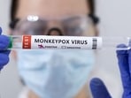 Swab samples for monkeypox being tested. (REUTERS file)