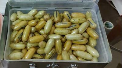 While it isn’t uncommon for the hospital to come across such a case, Tshouke’s situation was challenging as laxatives could expel only 115 pellets (HT Photo) While it isn’t uncommon for the hospital to come across such a case, Tshouke’s situation was challenging as laxatives could expel only 115 pellets (HT Photo)