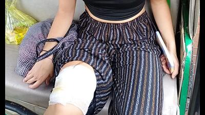 A Spanish woman tourist, who was bitten by a monkey at the Taj Mahal being provided treatment on Wednesday. (ht photo) A Spanish woman tourist, who was bitten by a monkey at the Taj Mahal being provided treatment on Wednesday. (ht photo)