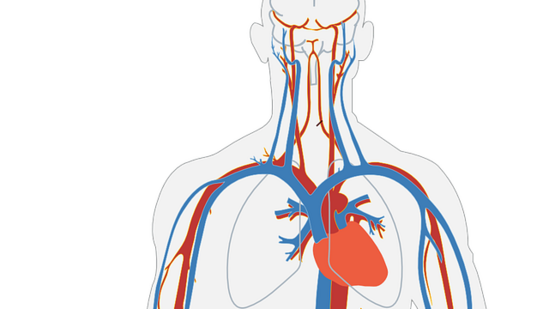 coronary artery disease causes