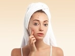 Period acne: Causes and tips to prevent it(freepik) Period acne: Causes and tips to prevent it(freepik)