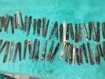 Docs took out 62 headless spoons from the patient's stomach and one from his intestine. Docs took out 62 headless spoons from the patient's stomach and one from his intestine.