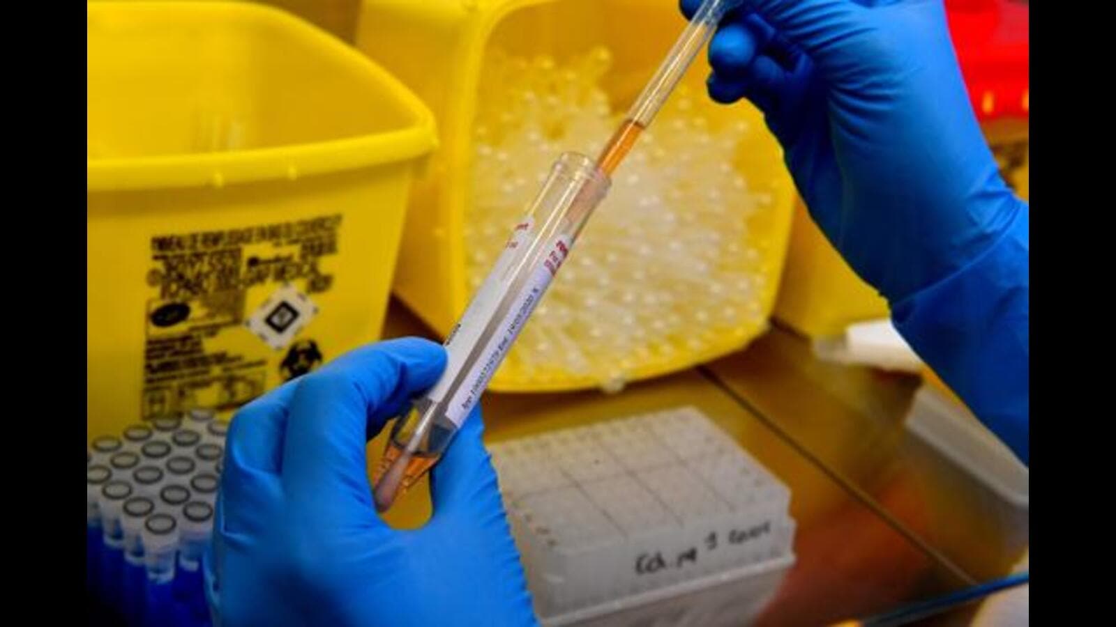 Propofol row at PGIMER: Drug was not of standard quality, finds lab ...
