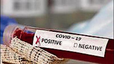 Currently, there are 13 active Covid cases in Ludhiana. One Covid case and five dengue cases were reported on Thursday. (HT FILE)