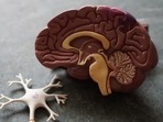 Researchers have been scrambling to find a treatment for Alzheimer’s for decades.