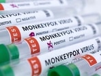 Another monkey virus on verge of infecting humans? Here is what Researchers say(HT_PRINT) Another monkey virus on verge of infecting humans? Here is what Researchers say(HT_PRINT)