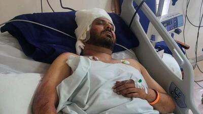 The singer was admitted to Fortis Hospital in Phase 8, Mohali, with multiple injuries on the head, arms and legs, and is now stated to be out of danger. (HT Photo)