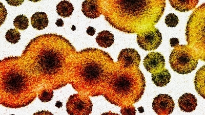 Protein could be used to produce life-saving antifungals: Research (Shutterstock/HT Archive) Protein could be used to produce life-saving antifungals: Research (Shutterstock/HT Archive)