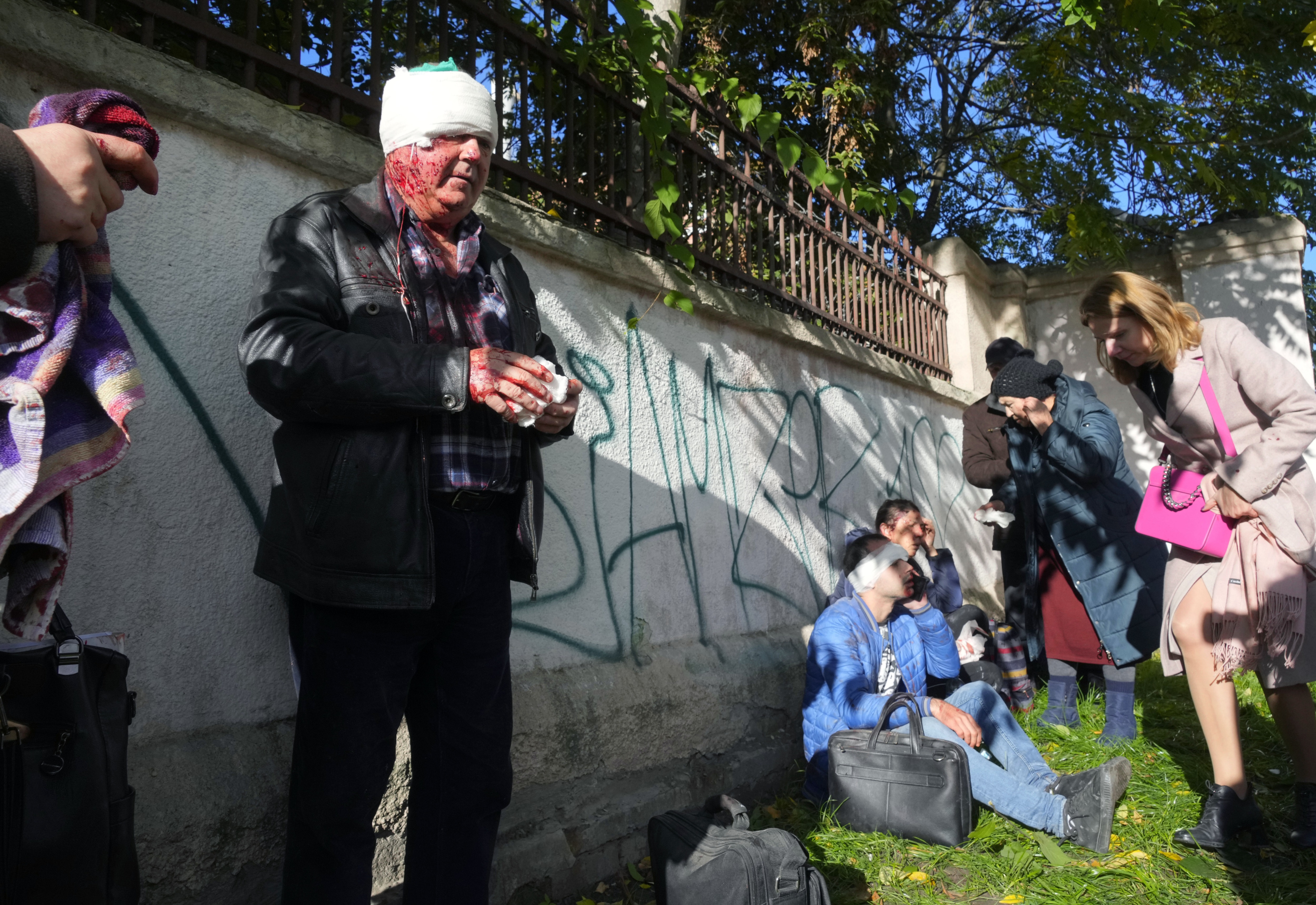 Russia-Ukraine War: People receive medical treatment at the scene of Russian shelling, in Kyiv, Ukraine. (AP)