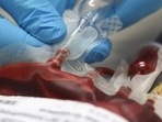 The officials have stated that hospitals will continue to carry out urgent, emergency or trauma surgery. The officials have stated that hospitals will continue to carry out urgent, emergency or trauma surgery.