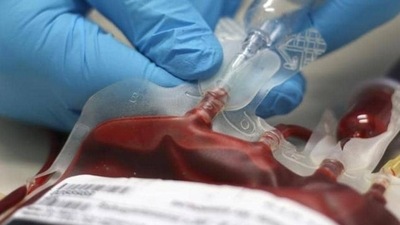 The officials have stated that hospitals will continue to carry out urgent, emergency or trauma surgery. (File)