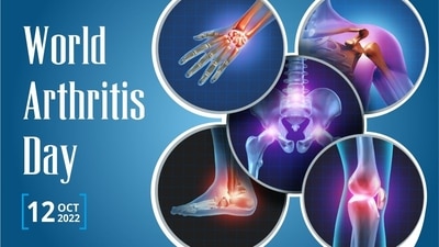 World Arthritis Day 2022: Can arthritis be reversed by exercise? Doctor answers (Twitter/PSGIMSR2)