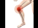 Osteoarthritis: Here's how stem cell therapy works as pain relief to heal knee joint swelling(Image by naturwohl-gesundheit from Pixabay ) Osteoarthritis: Here's how stem cell therapy works as pain relief to heal knee joint swelling(Image by naturwohl-gesundheit from Pixabay )
