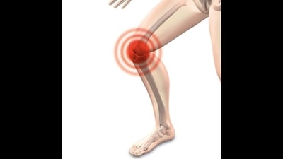 Osteoarthritis: Here's how stem cell therapy works as pain relief to heal knee joint swelling (Image by naturwohl-gesundheit from Pixabay ) Osteoarthritis: Here's how stem cell therapy works as pain relief to heal knee joint swelling (Image by naturwohl-gesundheit from Pixabay )