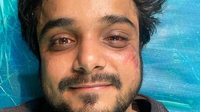 After I posted the picture, I started getting calls from a man named Saqib Khan, threatening me to stay away from Nikita,” said the victim, a resident of Mariyan House on 29th Road in Bandra West. (HT Photo) After I posted the picture, I started getting calls from a man named Saqib Khan, threatening me to stay away from Nikita,” said the victim, a resident of Mariyan House on 29th Road in Bandra West. (HT Photo)