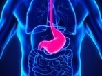 Environmental chemicals that influence gastrointestinal inflammation: Research