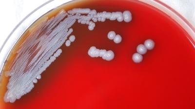 Due to the cytometry's nanoscale sensitivity, even the smallest physical alterations in bacterial cells could be detected. (Representational image/ AP)