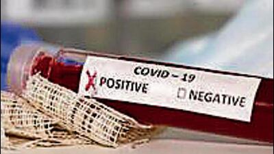 There were 15 active Covid cases in Ludhiana on Saturday. (HT FILE)
