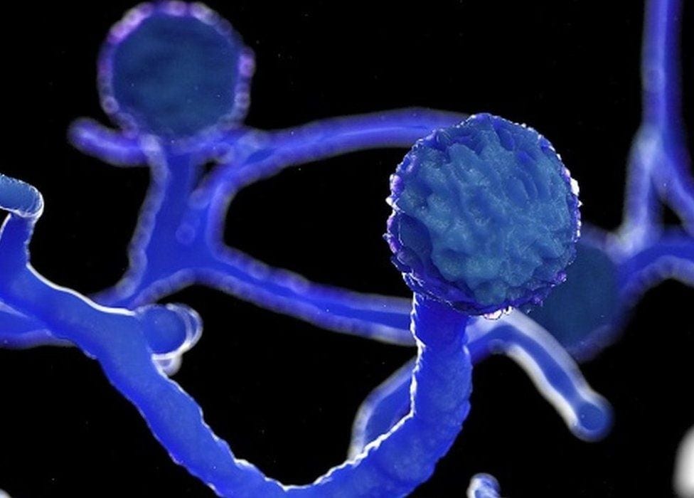 During Covid pandemic, incidence of comorbid invasive fungal infections saw a rise. (IStock) During Covid pandemic, incidence of comorbid invasive fungal infections saw a rise. (IStock)