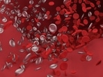 What is thrombosis and which body parts does it impact? Doctor reveals factors that raises its possibility and more (Image by Narupon Promvichai from Pixabay ) What is thrombosis and which body parts does it impact? Doctor reveals factors that raises its possibility and more (Image by Narupon Promvichai from Pixabay )