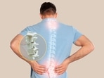 Doctor answers FAQS related to Osteoporosis, shares tips to prevent this bone disease (Twitter/Orthocore256) Doctor answers FAQS related to Osteoporosis, shares tips to prevent this bone disease (Twitter/Orthocore256)