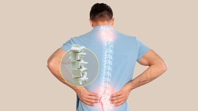 Doctor answers FAQS related to Osteoporosis, shares tips to prevent this bone disease (Twitter/Orthocore256) Doctor answers FAQS related to Osteoporosis, shares tips to prevent this bone disease (Twitter/Orthocore256)