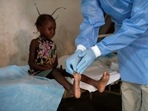 Monkeypox is a viral zoonotic disease that occurs primarily in tropical rainforest areas of central and west Africa and is occasionally exported to other regions.