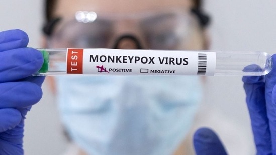 'Considerable' monkeypox transmission happens before symptoms: Study
