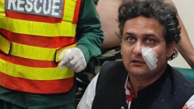 Pakistan Tehreek-e-Insaf (PTI) leader Faisal Javed Khan injured after the attack. (ARY news) Pakistan Tehreek-e-Insaf (PTI) leader Faisal Javed Khan injured after the attack. (ARY news)