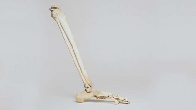 Adult cancer survivors at higher risk of bone fractures: Research (Yahoo) Adult cancer survivors at higher risk of bone fractures: Research (Yahoo)