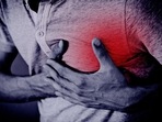 Pneumonia triggers heart attack. Here are its symptoms and prevention tips (Image by Tumisu from Pixabay ) Pneumonia triggers heart attack. Here are its symptoms and prevention tips (Image by Tumisu from Pixabay )