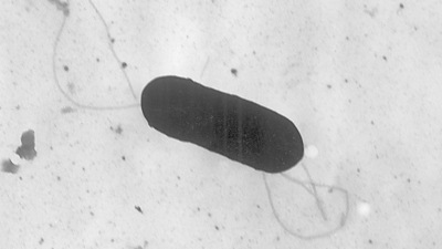 Listeria Infection In US: Six US states have reported cases of Listeria infection. (AP) Listeria Infection In US: Six US states have reported cases of Listeria infection. (AP)
