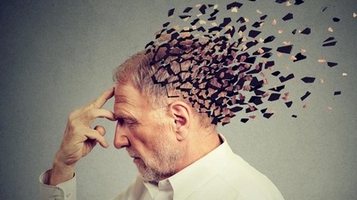 The study is published in Nature Medicine and is timely in light of the recent development of new drugs for Alzheimer's disease. (Shutterstock) The study is published in Nature Medicine and is timely in light of the recent development of new drugs for Alzheimer's disease. (Shutterstock)